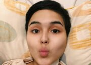 Mengenang Sosok Edelenyi Laura: Selebgram Inspiratif yang Gigih Melawan Ketidakadilan