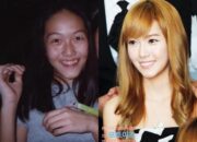 10 Artis Korea yang Diidamkan untuk Operasi Plastik Siapa Saja Mereka?