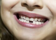 Arti Mimpi Copot Gigi Bawah Menurut Islam: Pertanda Kehilangan di Lingkungan Terdekat?