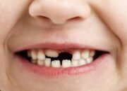 Arti Mimpi 2 Gigi Depan Atas Copot Menurut Islam: Tafsir dan Maknanya