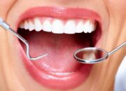 Cabut Gigi Geraham Berlubang: Prosedur Biaya dan Tips Perawatan!