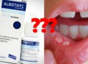 Viral Larangan Albothyl untuk Sariawan: Ini 5 Alasan Pentingnya Melek Obat